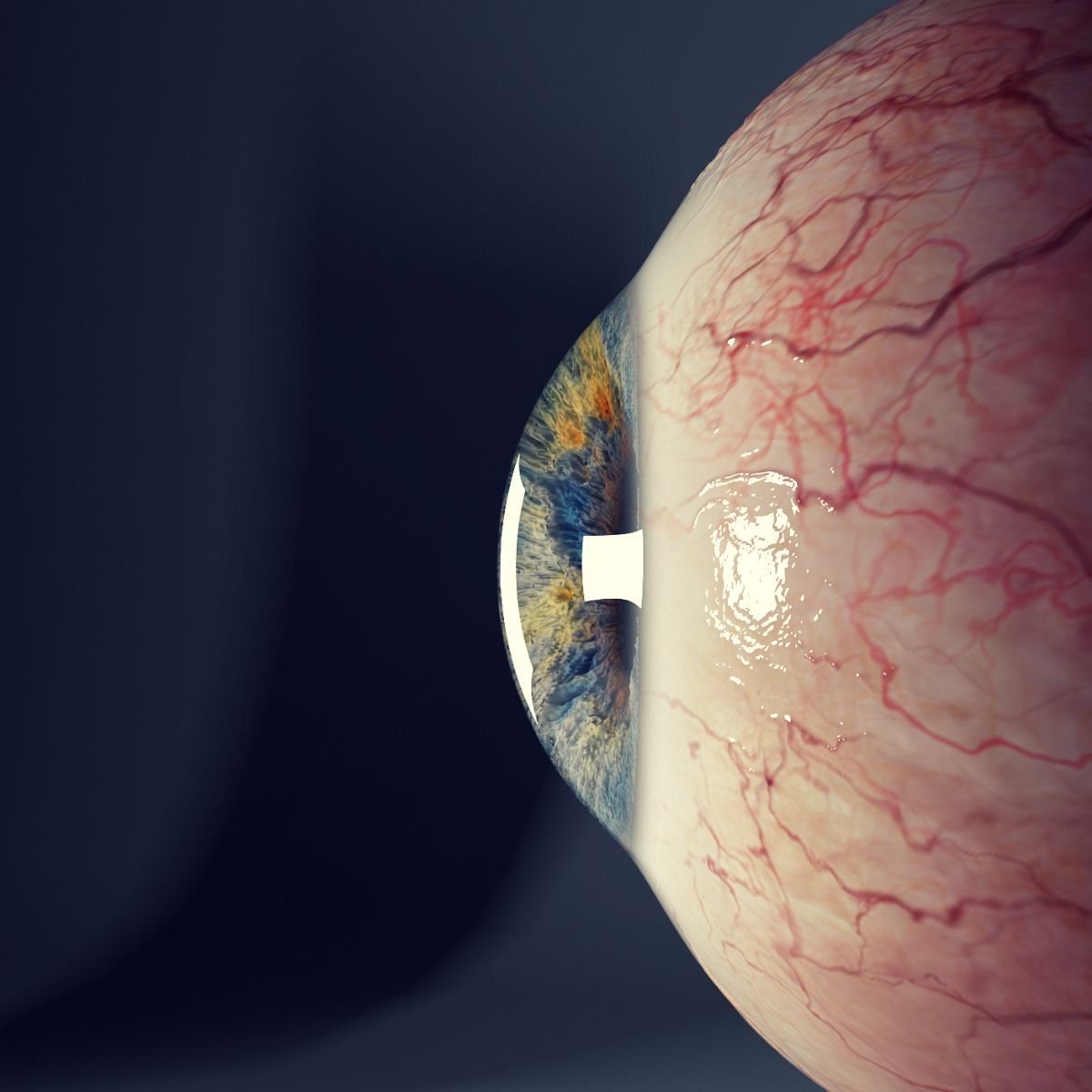 3D-Printed Cornea