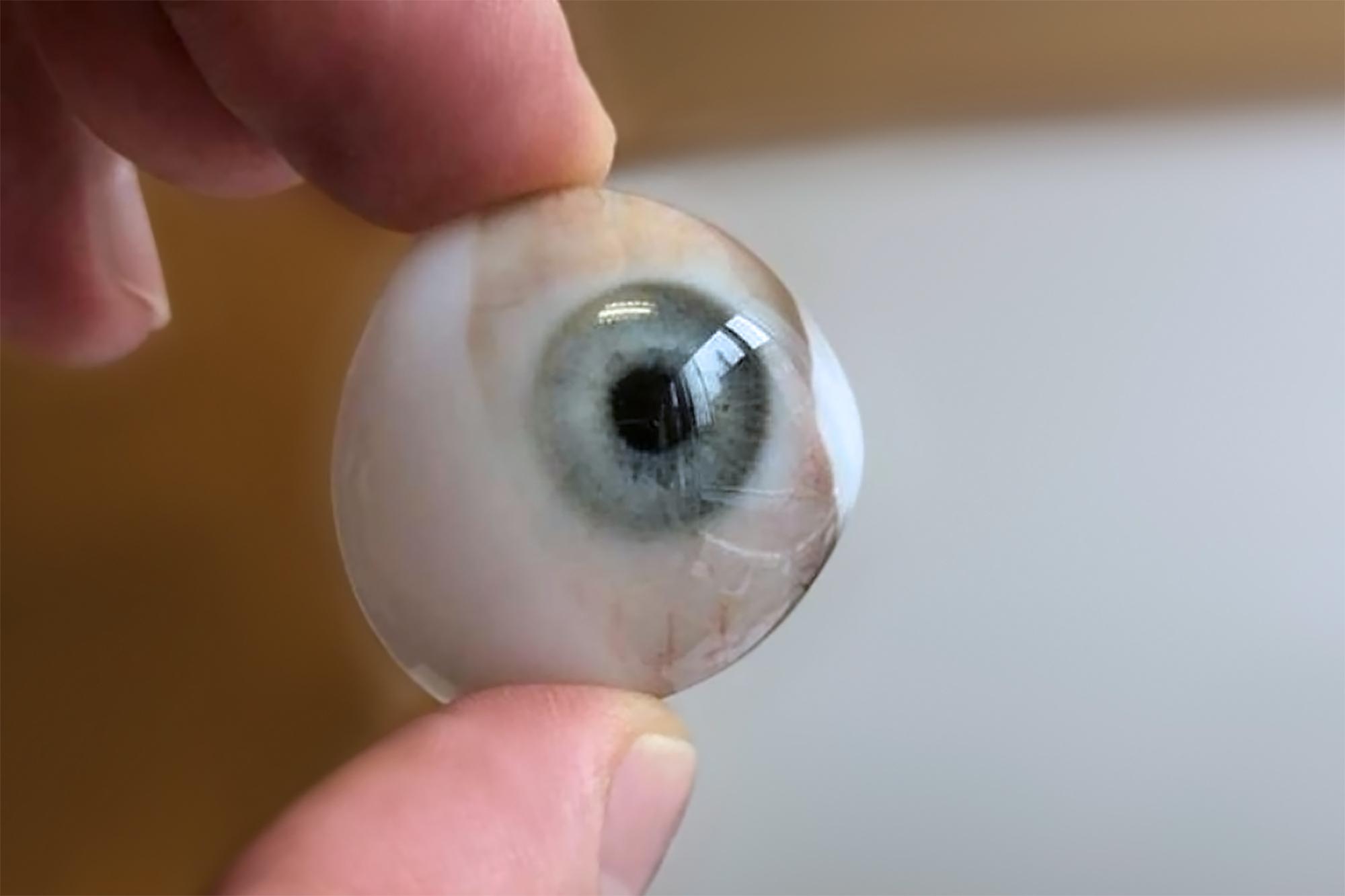 3D-Printed Ocular Prosthetics