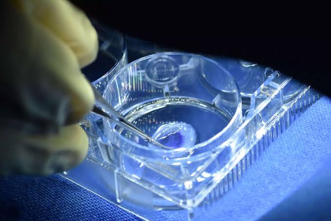 Next-Gen Global Ocular Innovations